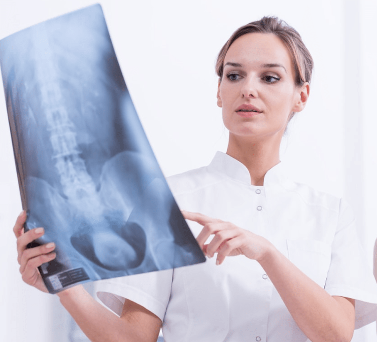 Diagnoza osteochondrozy klatki piersiowej za pomocą badania rentgenowskiego